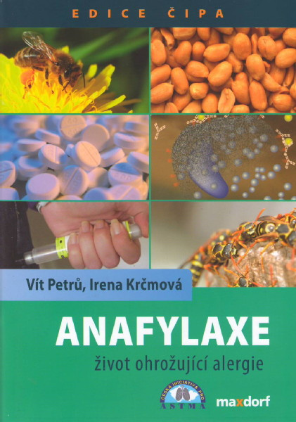 Anafylaxe život ohrožující alergie