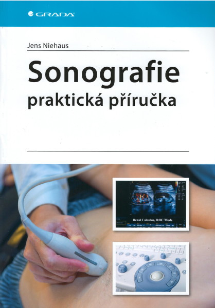 Sonografie - praktická příručka