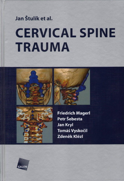 Cervical spine trauma