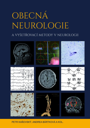 Obecná neurologie a vyšetřovací metody v neurologii